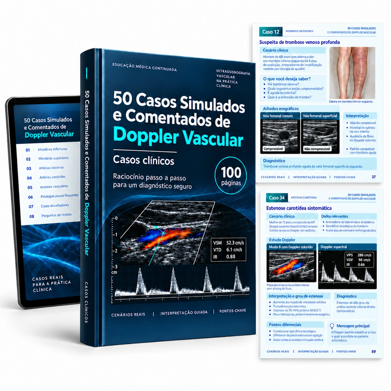 Representação digital: 50 Casos Simulados e Comentados de Doppler Vascular