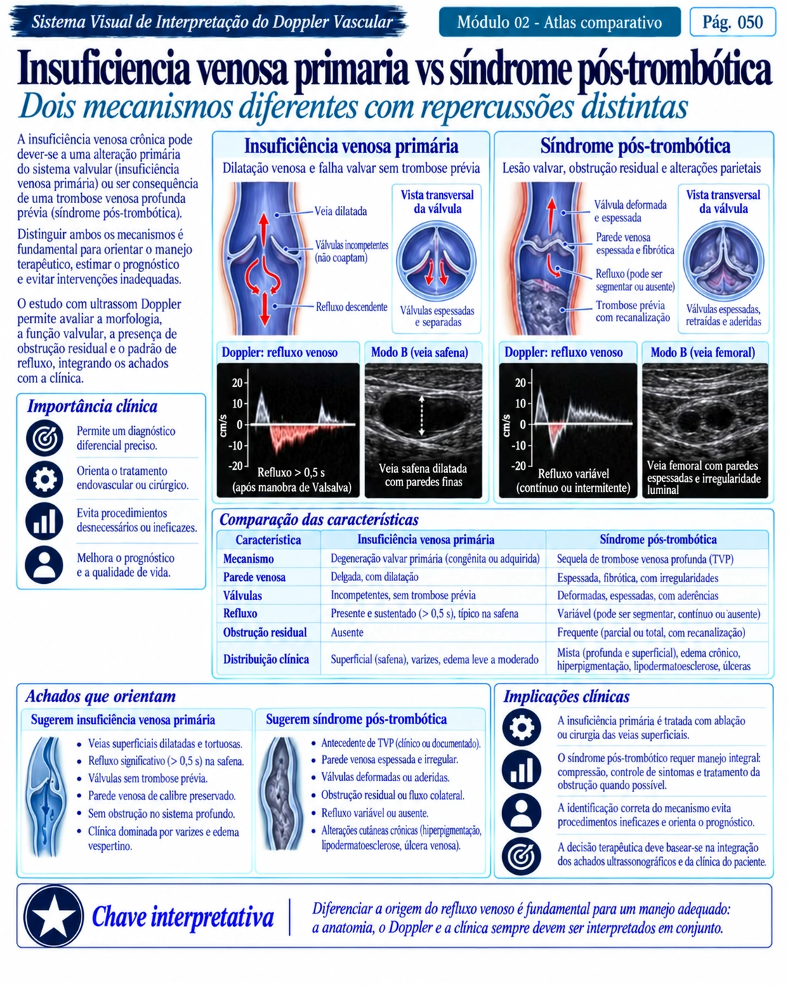 Página 50: Insuficiência venosa e síndrome pós-trombótica. Amostra do material digital de Doppler vascular.