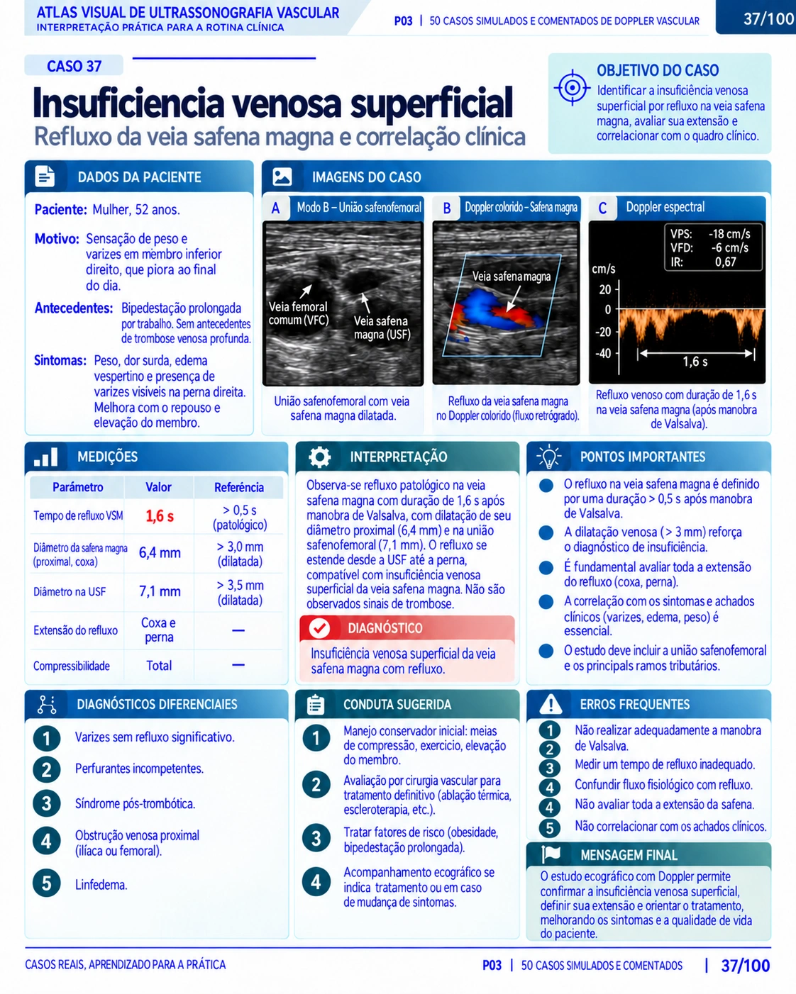 Página 37: Caso: insuficiência venosa superficial. Amostra do material digital de Doppler vascular.