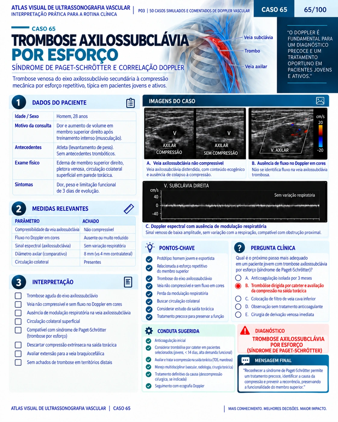 Página 65: Caso: trombose axilossubclávia. Amostra do material digital de Doppler vascular.