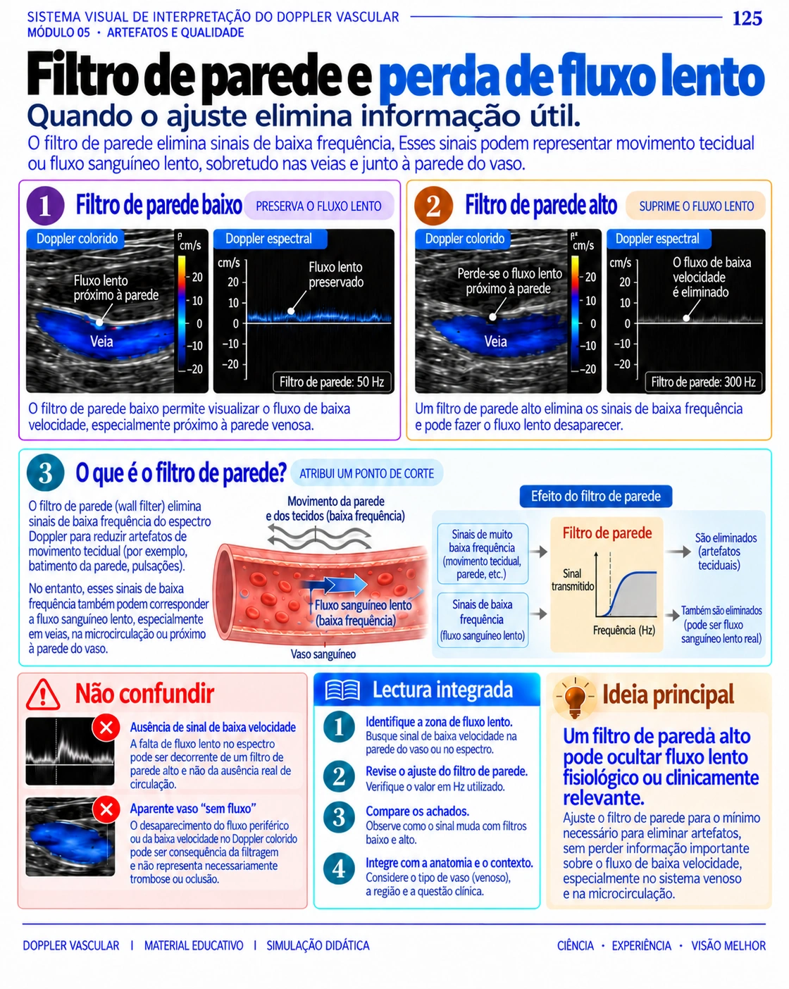 Página 125: Filtro de parede e fluxo lento. Amostra do material digital de Doppler vascular.